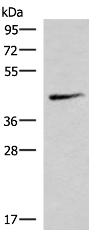 Rabbit Polyclonal Antibody to SMPD2