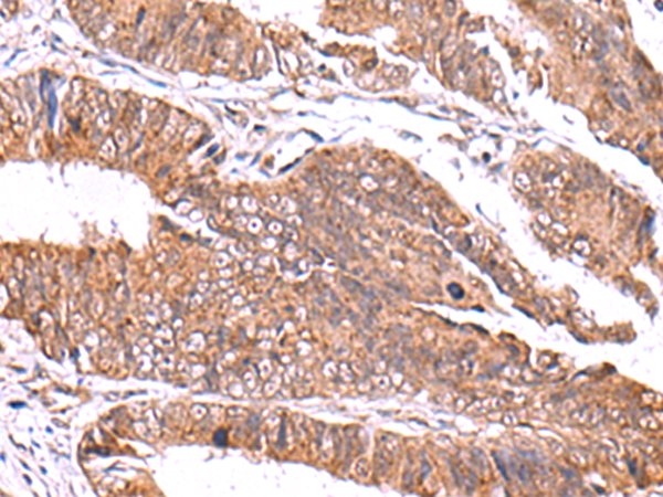 Rabbit Polyclonal Antibody to GATM