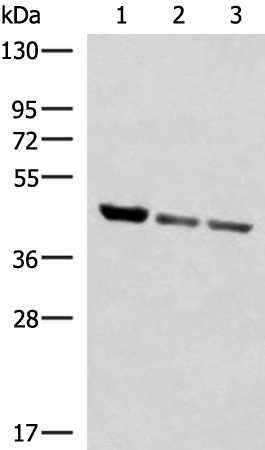 Rabbit Polyclonal Antibody to SCCPDH