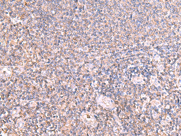 Rabbit Polyclonal Antibody to IFT57