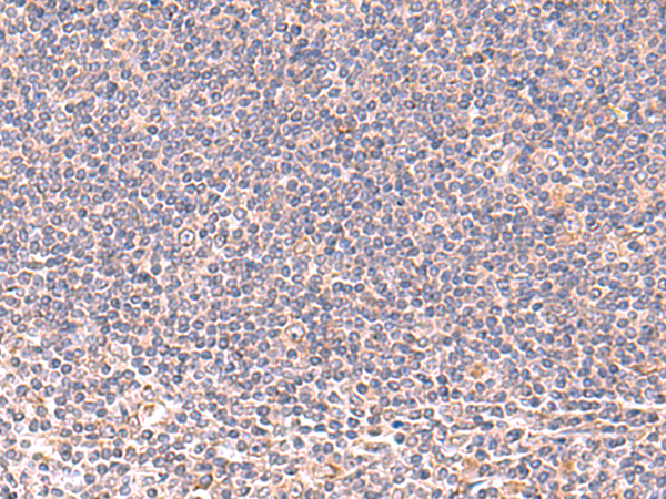 Rabbit Polyclonal Antibody to MANSC1