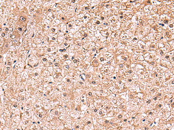 Rabbit Polyclonal Antibody to RUSC1