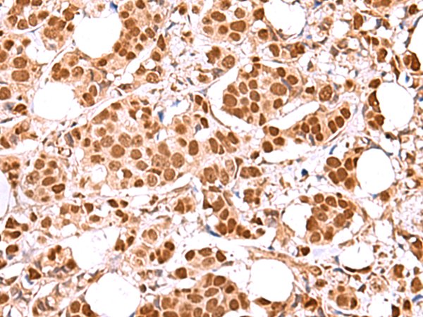 Rabbit Polyclonal Antibody to RCOR3