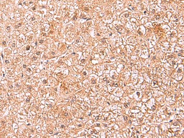 Rabbit Polyclonal Antibody to ASTN2