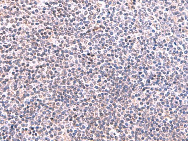 Rabbit Polyclonal Antibody to KIR3DL1