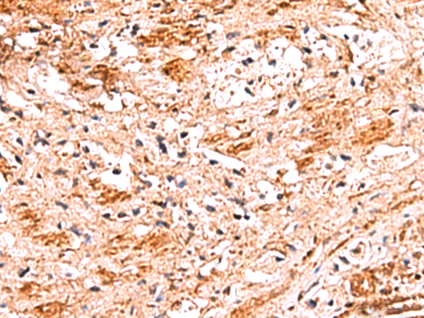 Rabbit Polyclonal Antibody to NADK