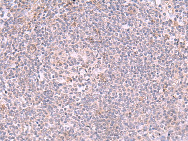 Rabbit Polyclonal Antibody to INPP5K