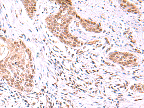 Rabbit Polyclonal Antibody to TRMT12