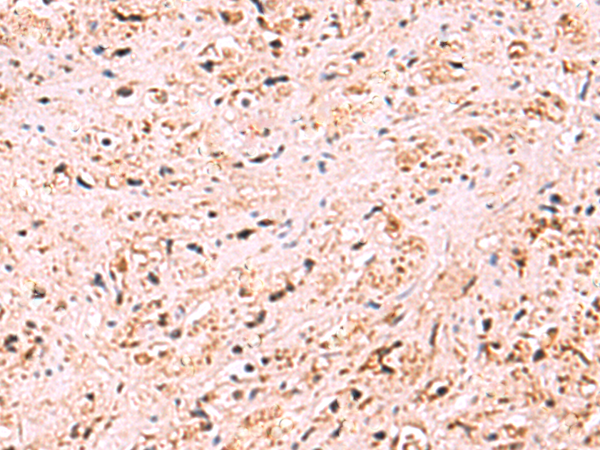 Rabbit Polyclonal Antibody to ZSWIM1
