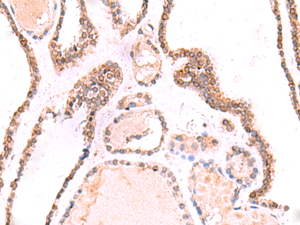 Rabbit Polyclonal Antibody to TOR1AIP1