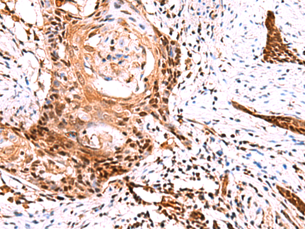 Rabbit Polyclonal Antibody to TSEN2
