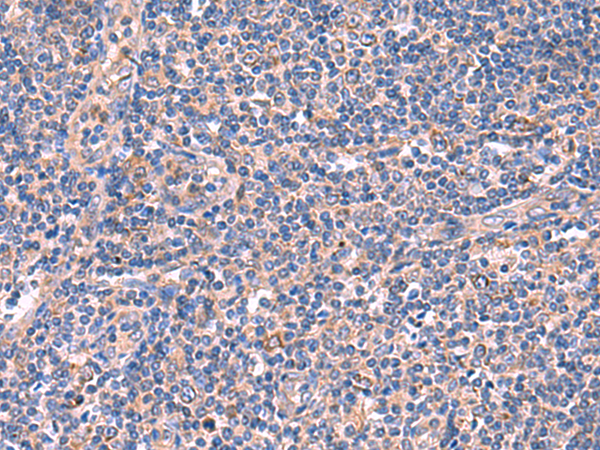 Rabbit Polyclonal Antibody to MPP1