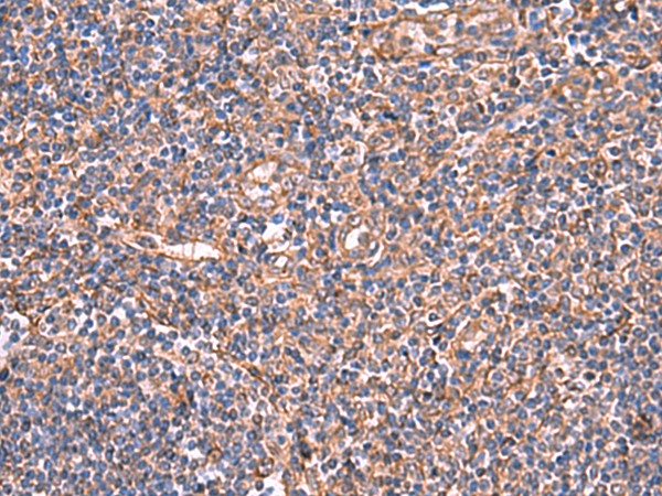 Rabbit Polyclonal Antibody to TTC38