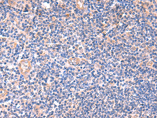 Rabbit Polyclonal Antibody to ZNF256