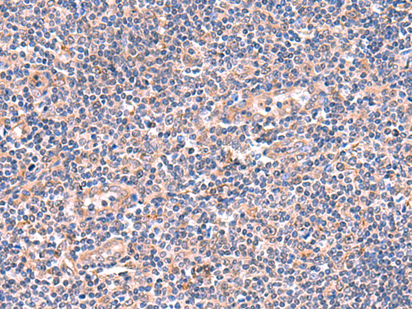 Rabbit Polyclonal Antibody to OSBPL2