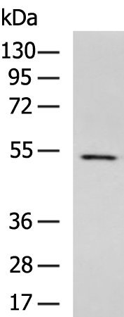 Rabbit Polyclonal Antibody to KATNAL1
