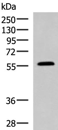 Rabbit Polyclonal Antibody to PEPD
