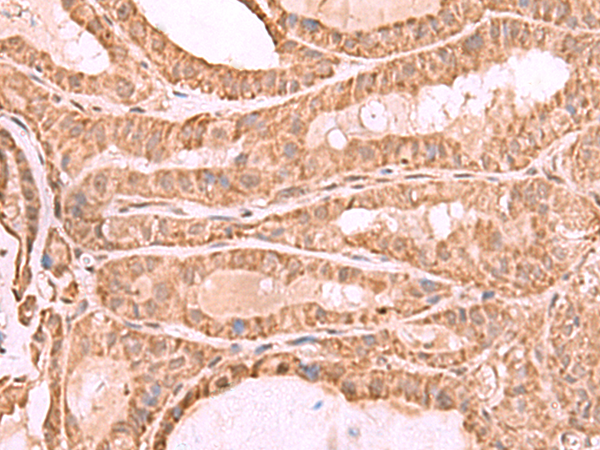 Rabbit Polyclonal Antibody to CDC20