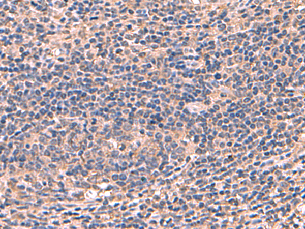 Rabbit Polyclonal Antibody to AHCYL1