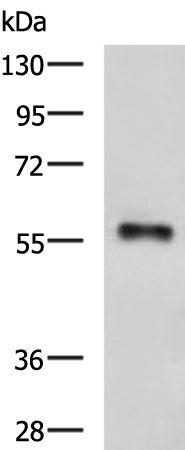 Rabbit Polyclonal Antibody to IKZF2