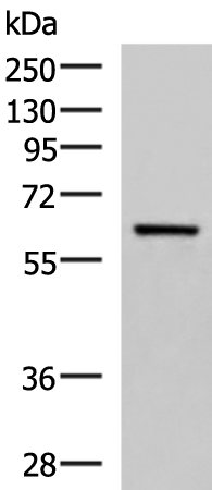 Rabbit Polyclonal Antibody to SARS1