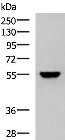 Rabbit Polyclonal Antibody to KPNA2