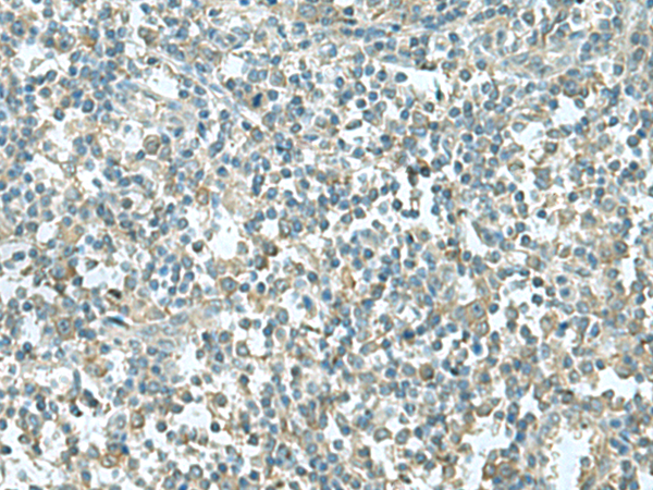 Rabbit Polyclonal Antibody to CCT5