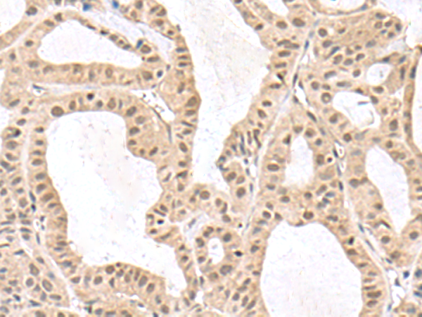 Rabbit Polyclonal Antibody to RPS6KA5