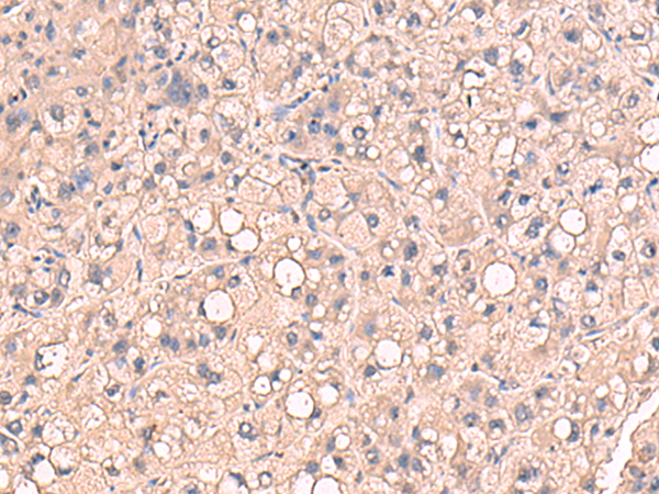 Rabbit Polyclonal Antibody to RIOK1