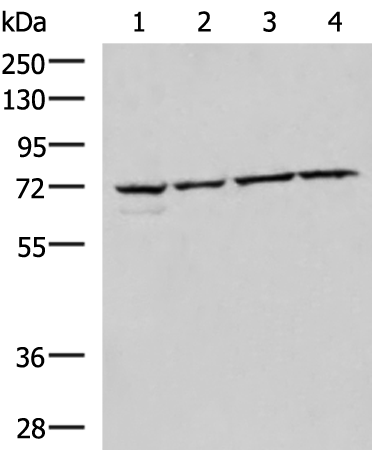 Rabbit Polyclonal Antibody to CBFA2T2