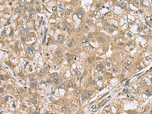 Rabbit Polyclonal Antibody to PAPSS2