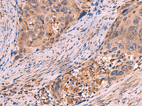 Rabbit Polyclonal Antibody to SHC4