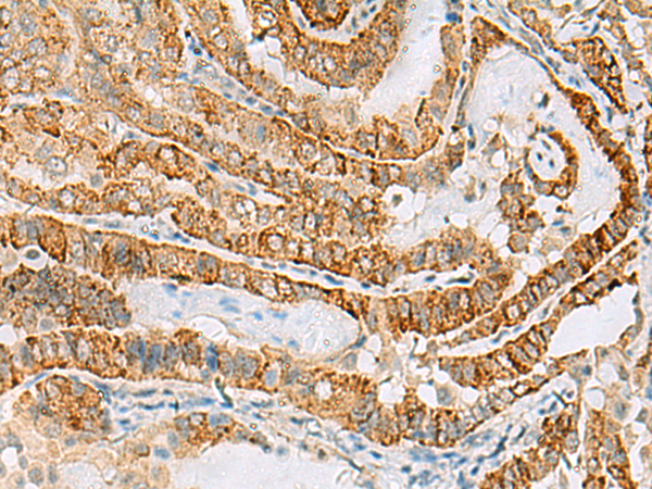 Rabbit Polyclonal Antibody to FARP2
