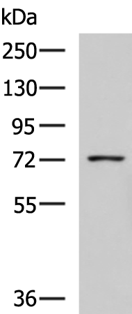 Rabbit Polyclonal Antibody to GUSB