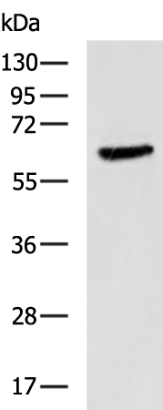 Rabbit Polyclonal Antibody to PPP2R1B