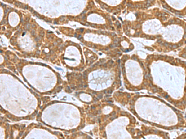 Rabbit Polyclonal Antibody to KIF2A