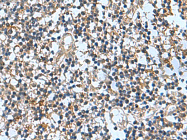 Rabbit Polyclonal Antibody to TRO