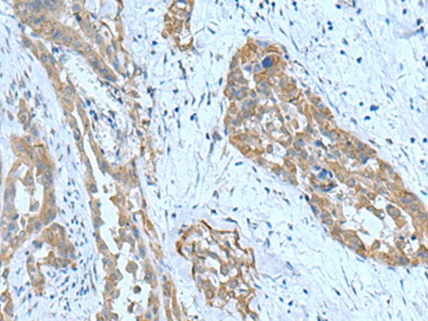 Rabbit Polyclonal Antibody to SRPK2