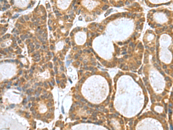 Rabbit Polyclonal Antibody to KANSL1L