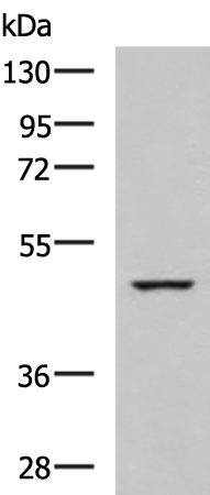 Rabbit Polyclonal Antibody to IP6K2