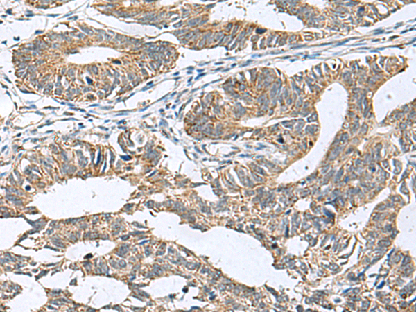 Rabbit Polyclonal Antibody to DPY19L3
