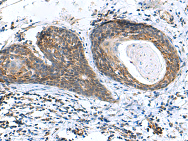 Rabbit Polyclonal Antibody to AP1S3