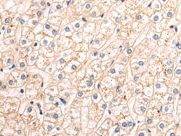 Rabbit Polyclonal Antibody to KCNE1