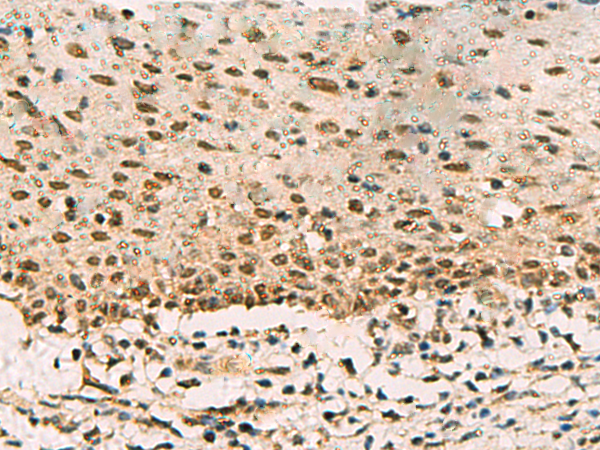 Rabbit Polyclonal Antibody to PHF5A