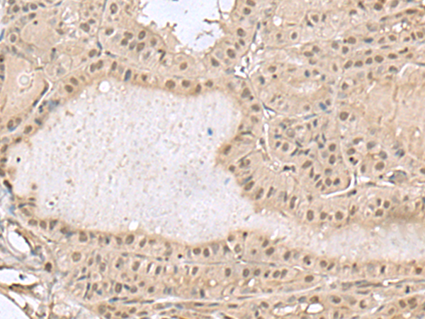 Rabbit Polyclonal Antibody to PCLAF