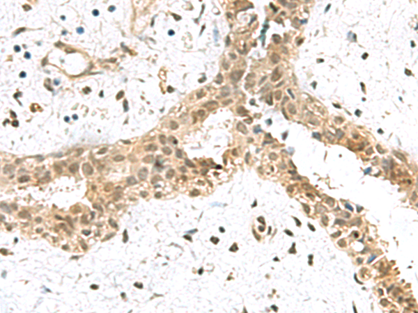 Rabbit Polyclonal Antibody to ELOC