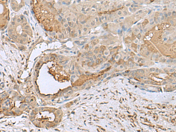 Rabbit Polyclonal Antibody to GABARAPL2