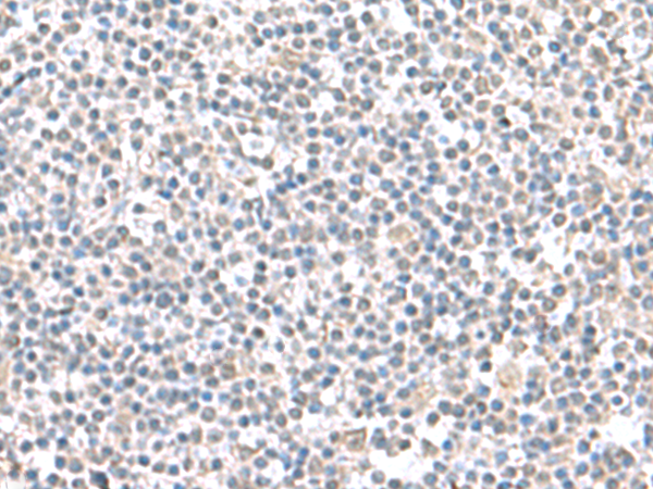 Rabbit Polyclonal Antibody to IFI27