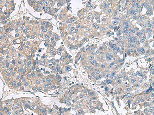Rabbit Polyclonal Antibody to NPHP1