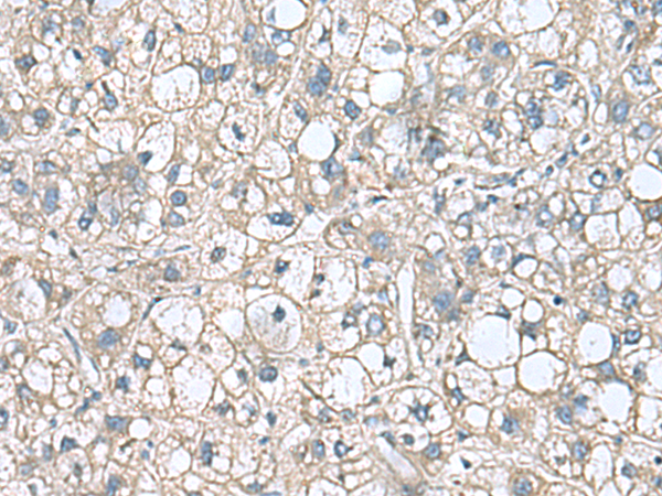 Rabbit Polyclonal Antibody to RHBDL2